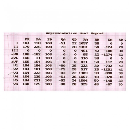 ECG papier voor Cardio