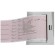 Appareil ECG Contec 600G