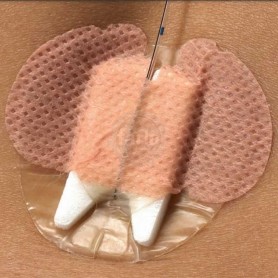 EPI-Guard Epiduraal katheterverband