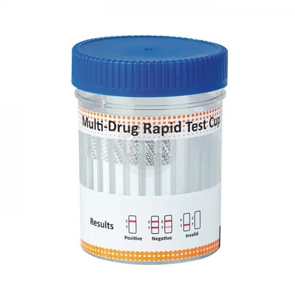 Un test urinaire de dépistage de drogue peut être prévu par le